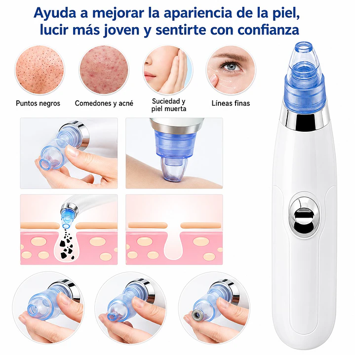 Extractor Removedor Puntos Negros Eléctrico Portátil 6