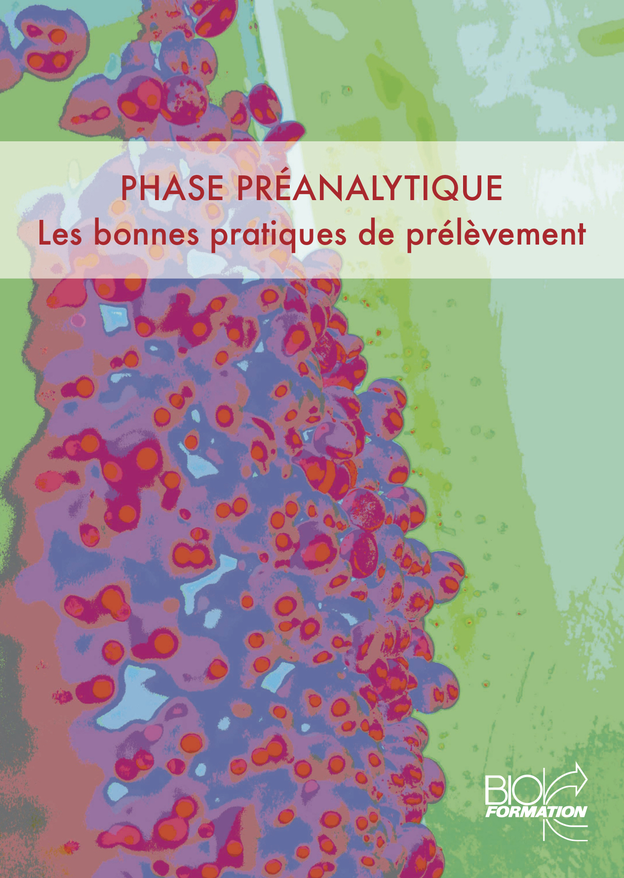 Phase préanalytique - Les bonnes pratiques de prélèvement