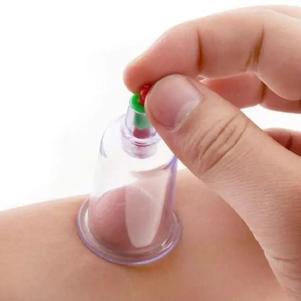 Ventosas Técnica China Elimina Dolores Celulitis 12 Copas 4