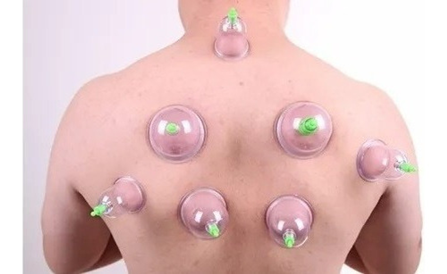 Set Ventosas Chinas 12 Ventosas De Vacio Ventosa Para Masaje 8