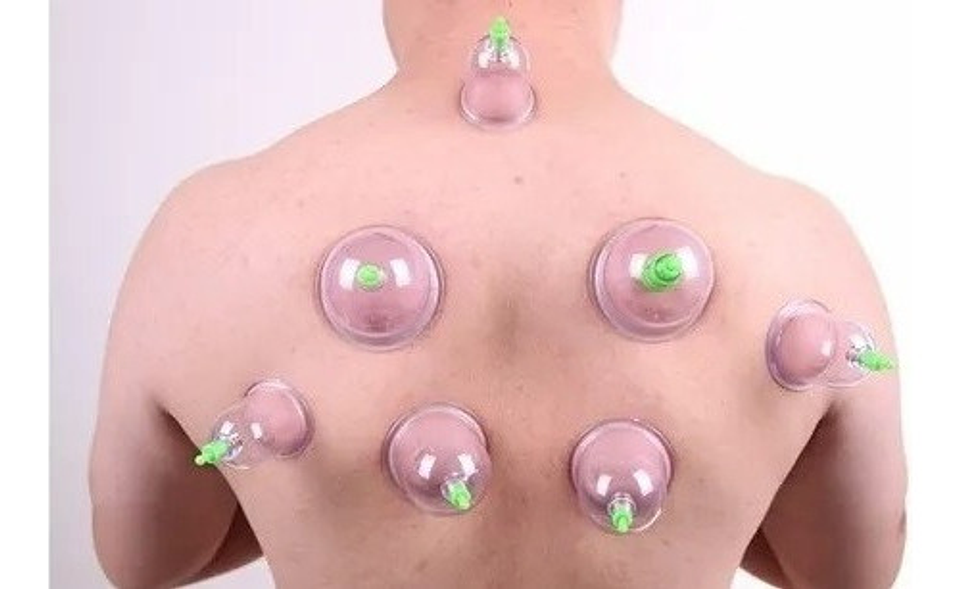 Set Ventosas Chinas 12 Ventosas De Vacio Ventosa Para Masaje 8