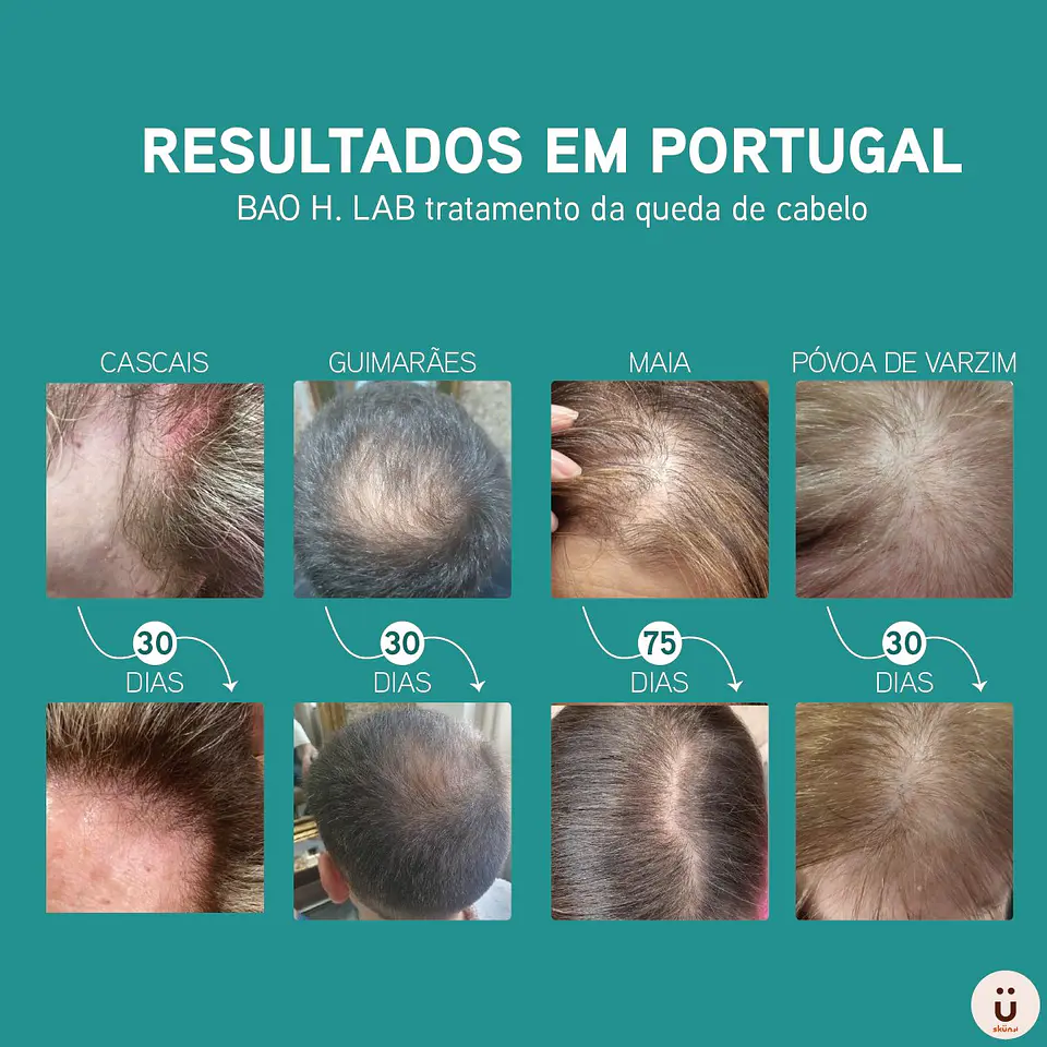Bao H Lab - Ampola de Tratamento Anti-Queda 2x amp 8