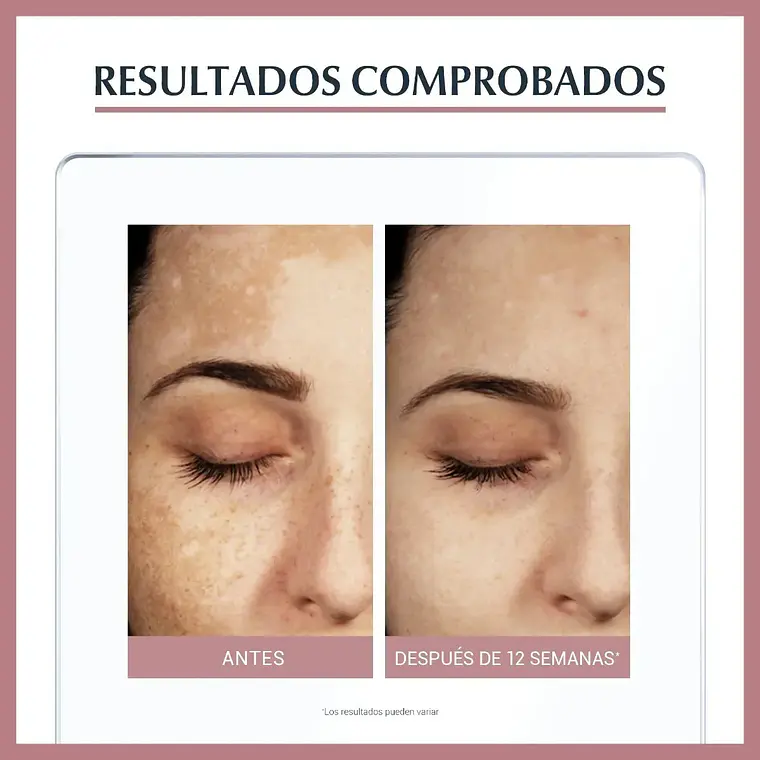 SERUM FACIAL ANTI PIGMENT DUAL 30ML 4