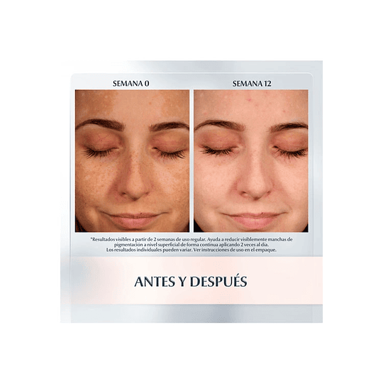 ANTI PIGMENT LAPIZ CORRECTOR 5ml