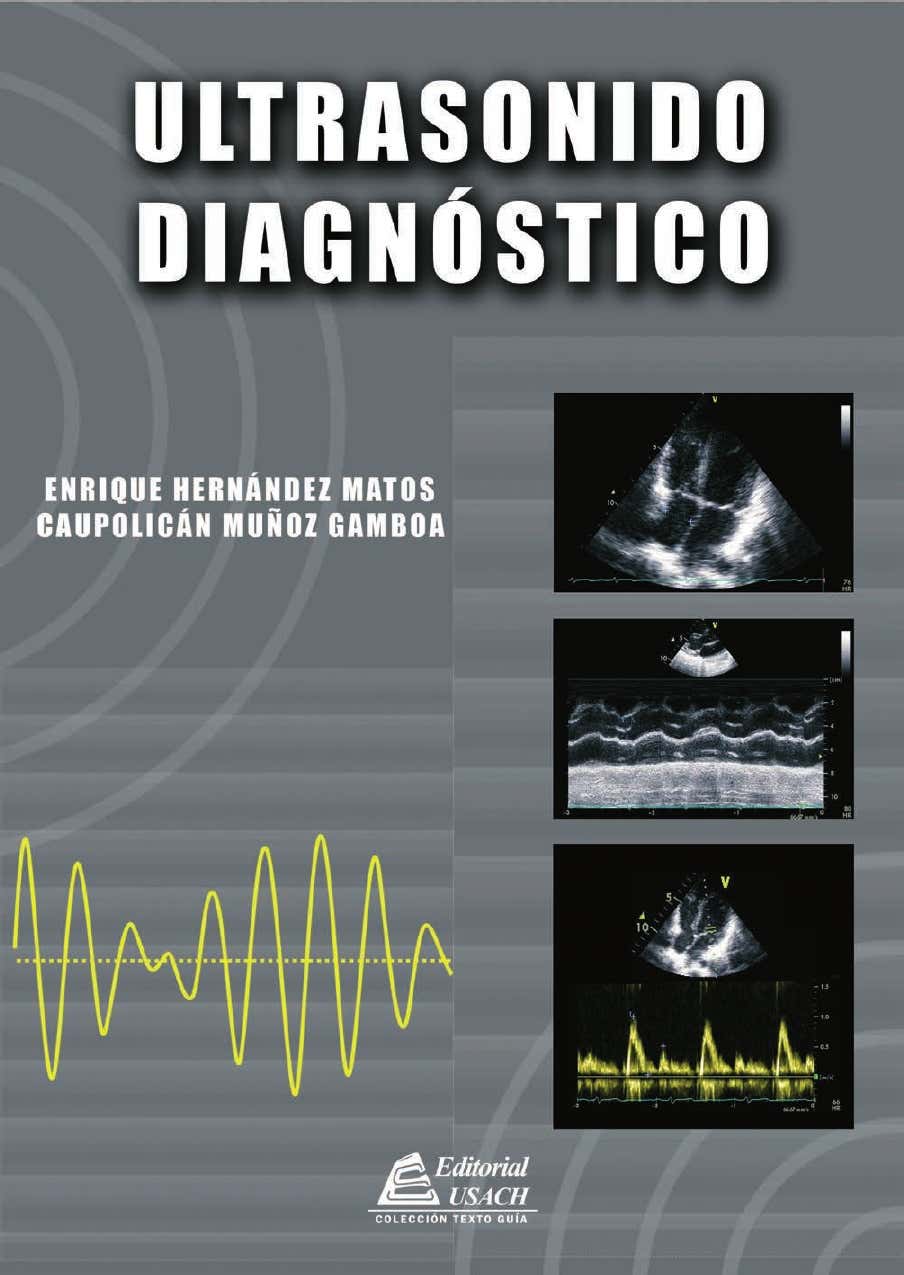 Ultrasonido diagnóstico