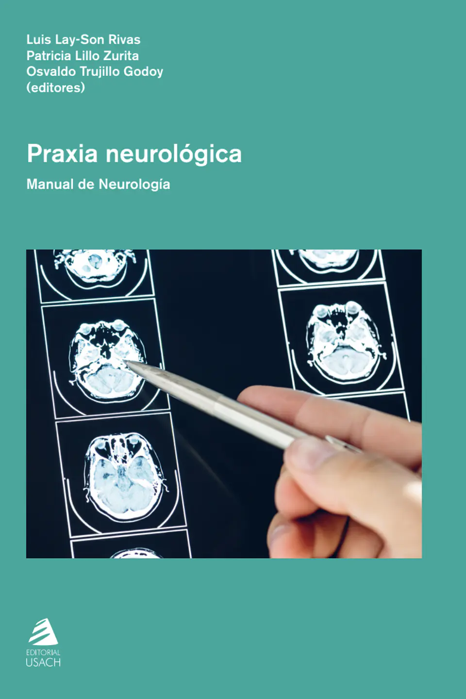 Praxia neurológica: manual de Neurología 1