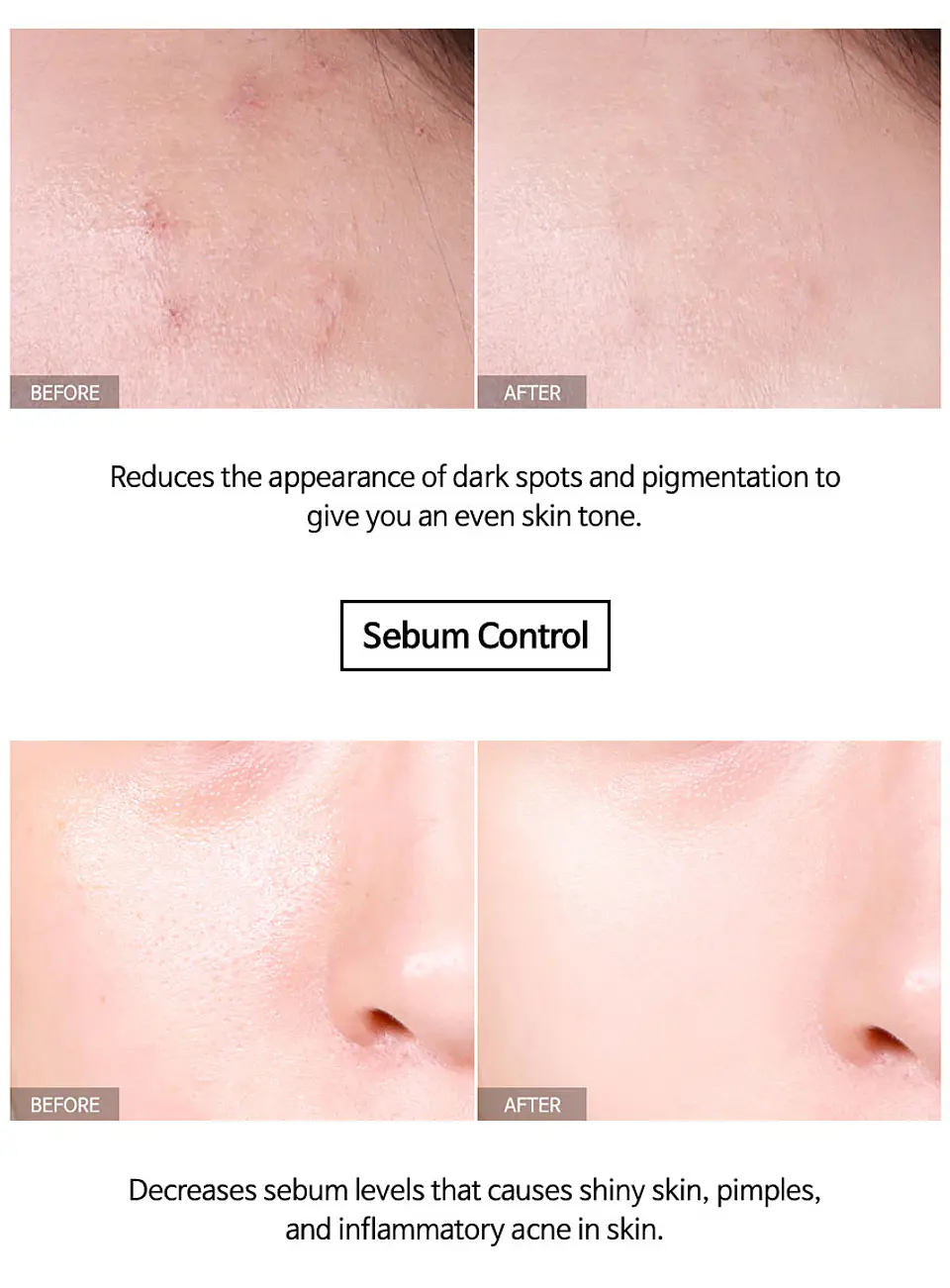 Vita B3 Source (TIAM) - 40ml Serum aclarante 10% Niacinamida + 2% arbutina Anti manchas 7