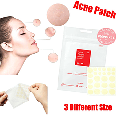 Acne Pimple Master Patch (COSRX) - Sobres con 24 parches hidrocoloides para espinillas
