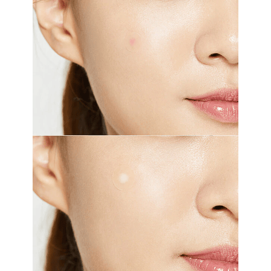 Acne Pimple Master Patch (COSRX) - Sobres con 24 parches en total