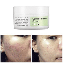 Centella Blemish Cream (COSRX) - 30ml Crema acné, rosácea, pieles sensibles