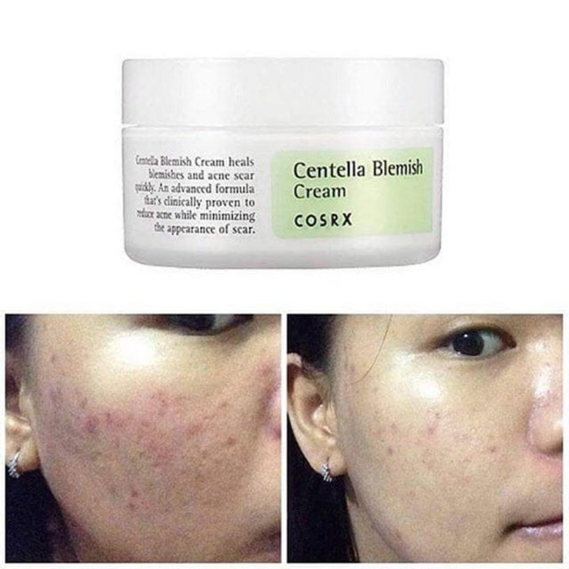 Centella Blemish Cream (COSRX) - 30ml Crema acné, rosácea, pieles sensibles 1