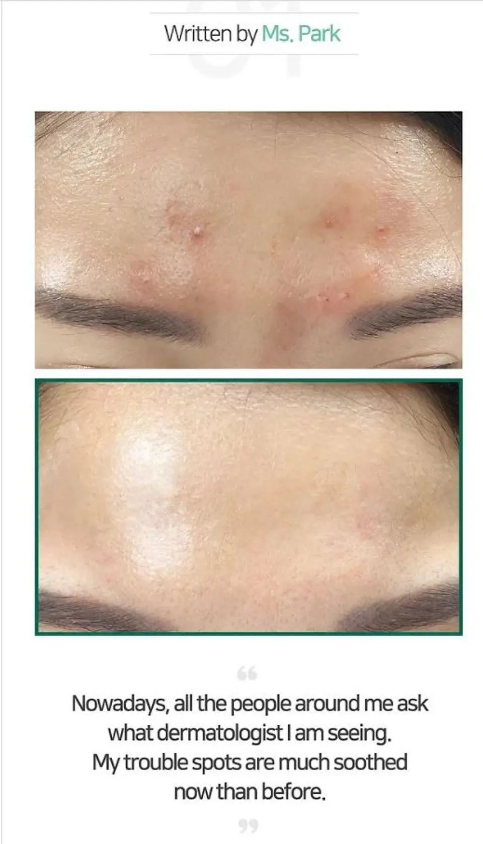 AHA BHA PHA 30 Days Miracle Toner (Some By Mi) - 150ml Tónico para pieles con problemas 8