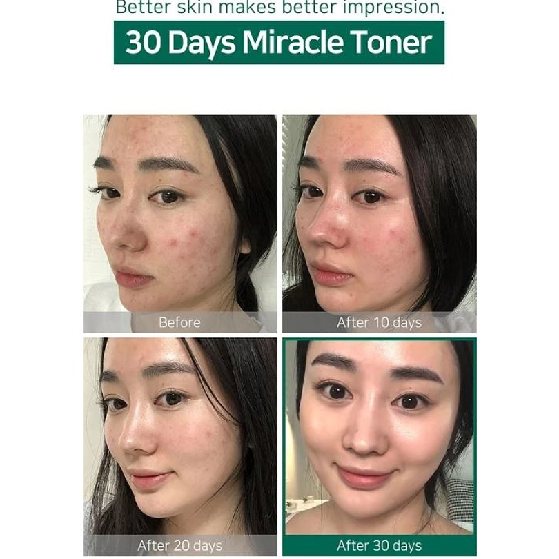  AHA BHA PHA 30 Days Miracle Toner  (Some By Mi) - 150ml Tónico para pieles con problemas 6