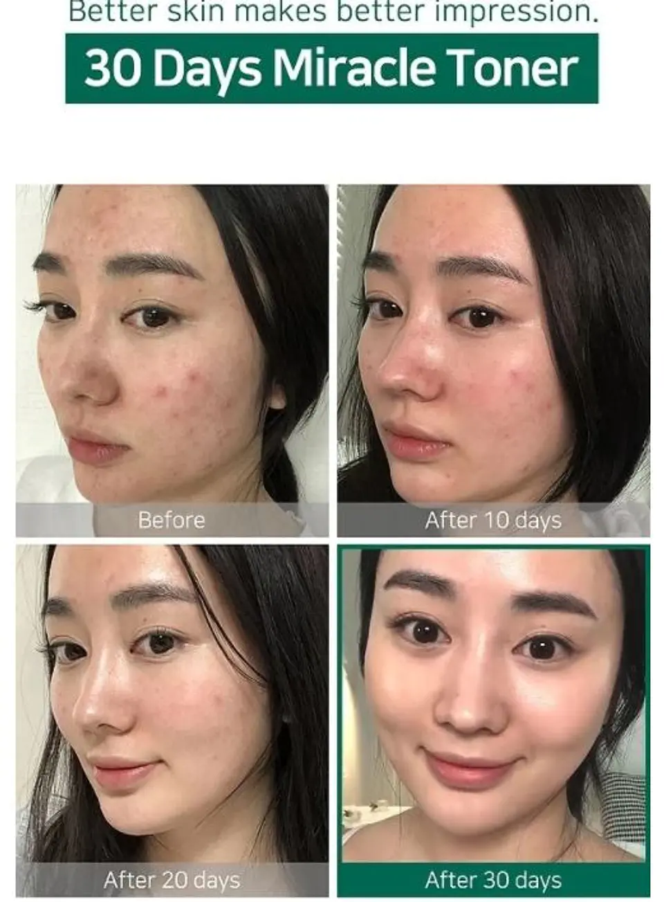 AHA BHA PHA 30 Days Miracle Toner (Some By Mi) - 150ml Tónico para pieles con problemas 10