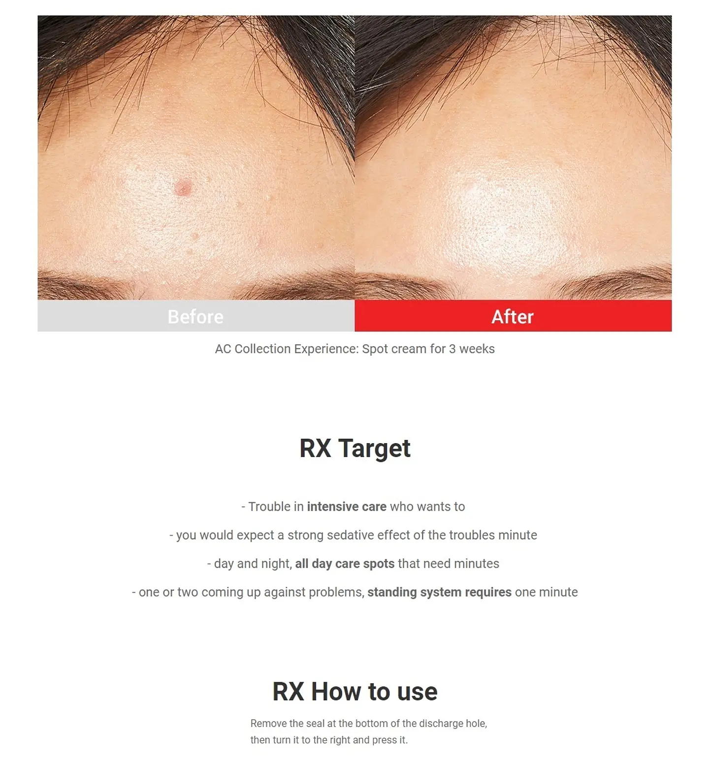 AC Fighting Spot Rx Cream (TIAM) -30ml Crema focalizada para tratamiento de espinillas y acné 8