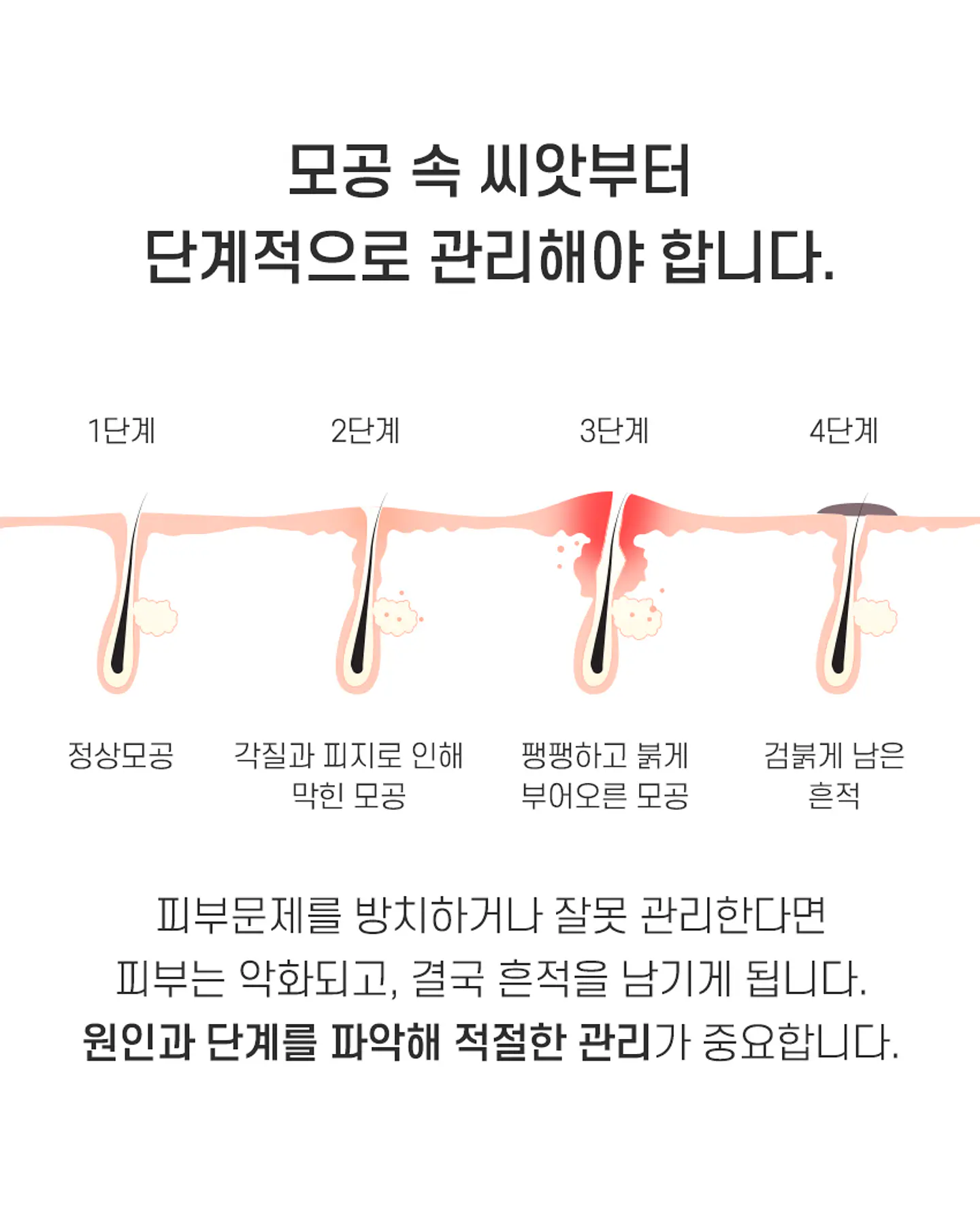 AC Fighting Spot Rx Cream (TIAM) -30ml Crema focalizada para tratamiento de espinillas y acné 9