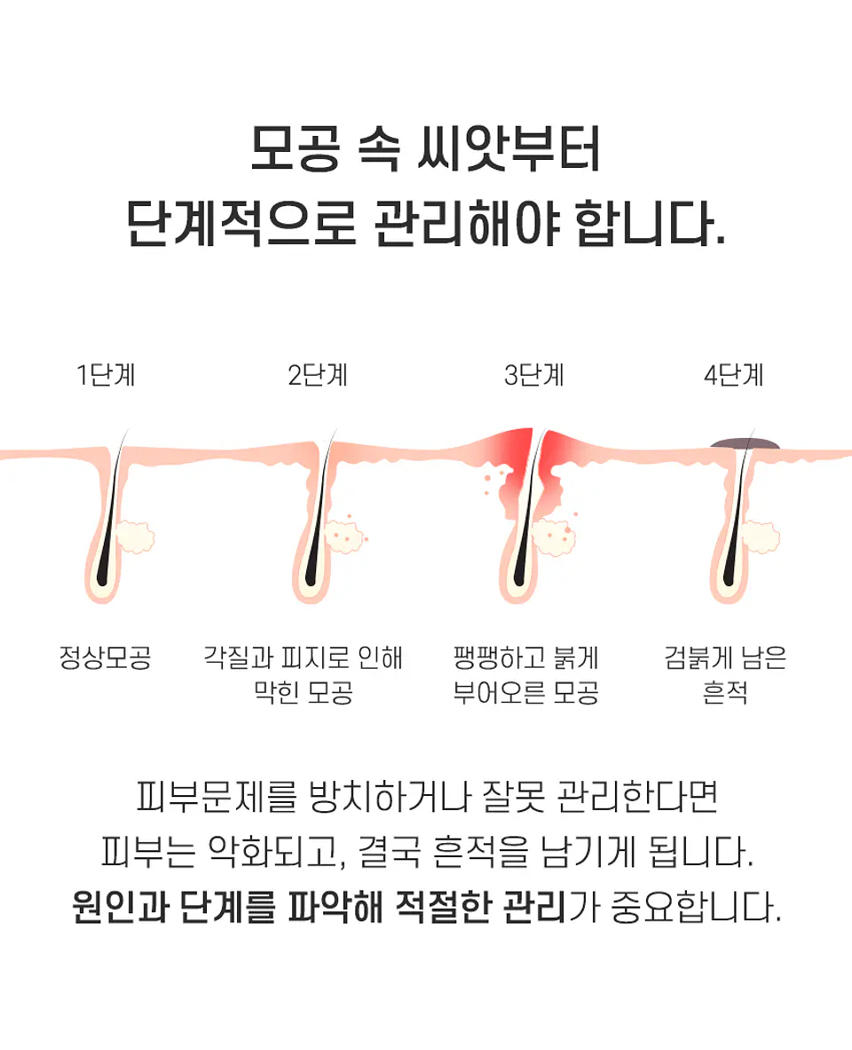 AC Fighting Spot Rx Cream (TIAM) -30ml Crema focalizada para tratamiento de espinillas y acné 9