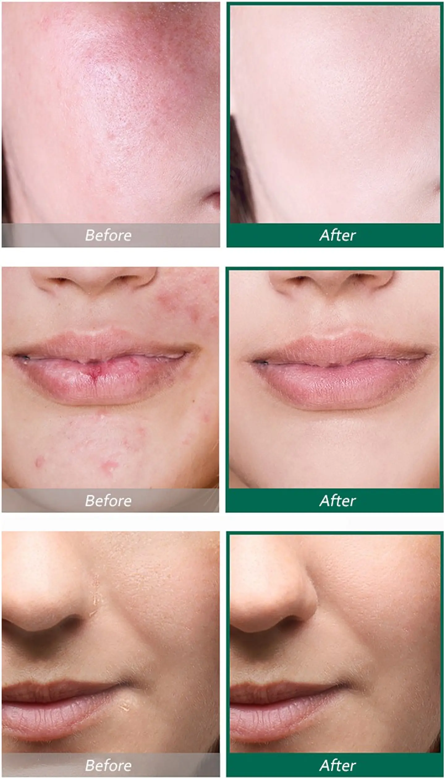 Pack AHA BHA PHA 30 days Miracle Tónico + Serum (Some By Mi)  3