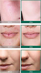 Pack AHA BHA PHA 30 days Miracle Tónico + Serum (Some By Mi)  - Miniatura 3