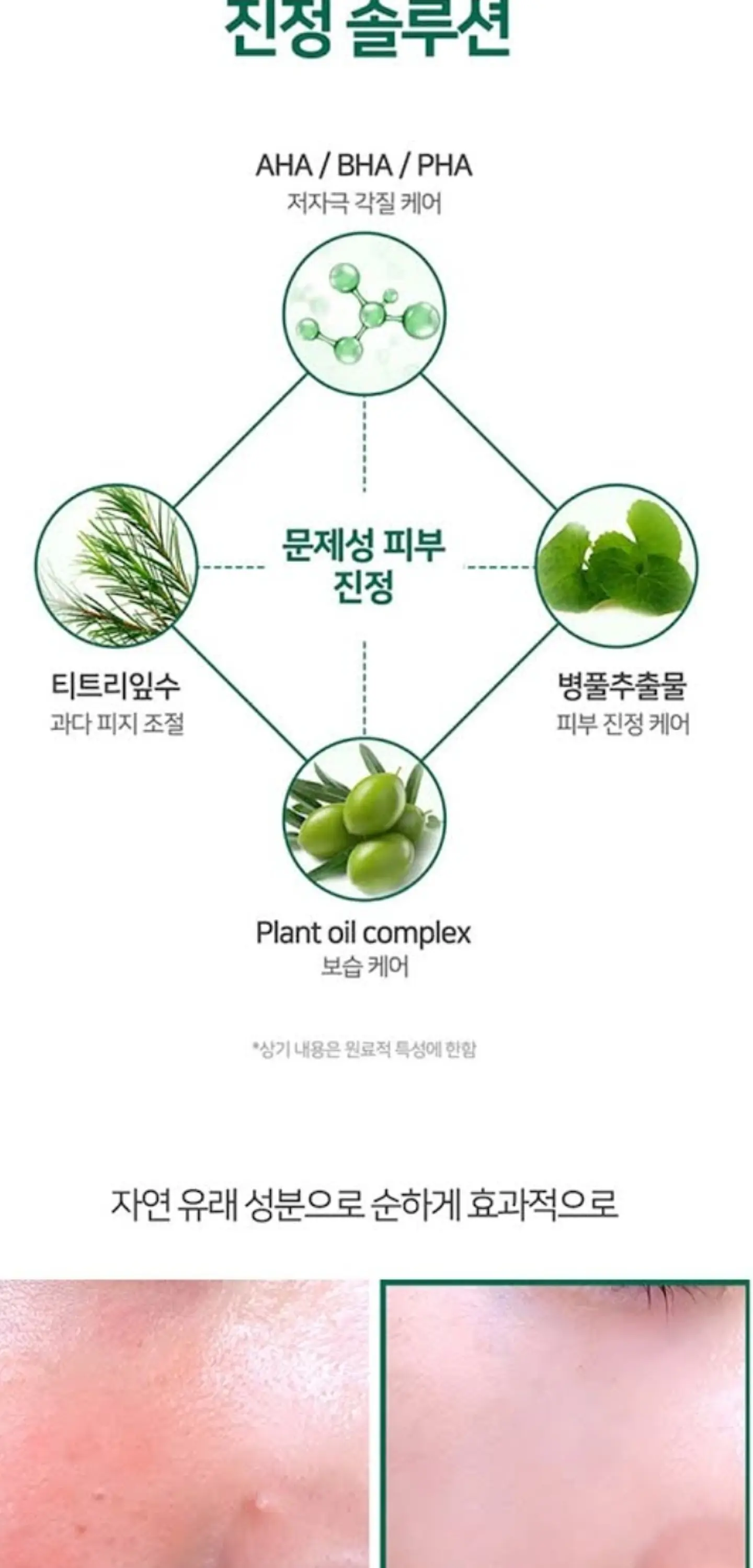 Pack AHA BHA PHA 30 days Miracle Tónico + Serum (Some By Mi)  4