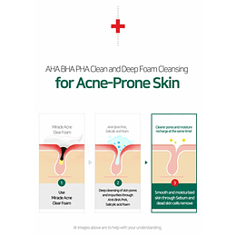 Aha-Bha-Pha 30 Days Miracle Acne Clear Foam (Some By Mi) – 150ml Limpiador pieles problemáticas