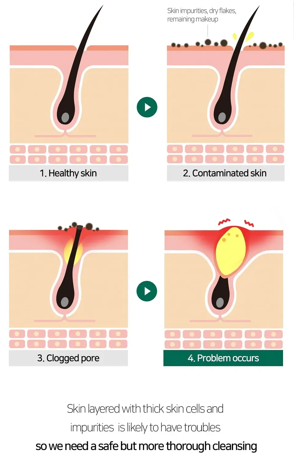AHA-BHA-PHA 30 Days Miracle Acne Clear Foam (Some By Mi) – 100ml Limpiador pieles problemáticas 5