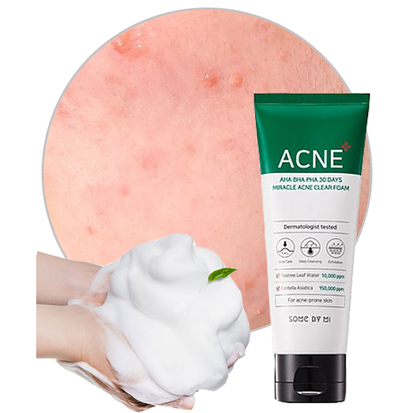 AHA-BHA-PHA 30 Days Miracle Acne Clear Foam (Some By Mi) – 100ml Limpiador pieles problemáticas 8
