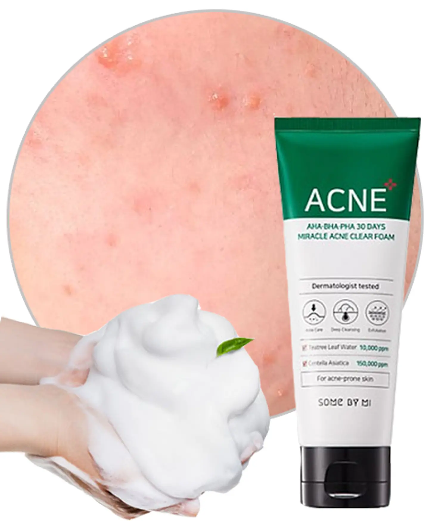 AHA-BHA-PHA 30 Days Miracle Acne Clear Foam (Some By Mi) – 100ml Limpiador pieles problemáticas 9