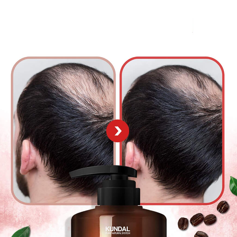  Caffeine Deep Cleansing Shampoo Anticaída de cabello con cafeína (Kundal) - 500ml 4