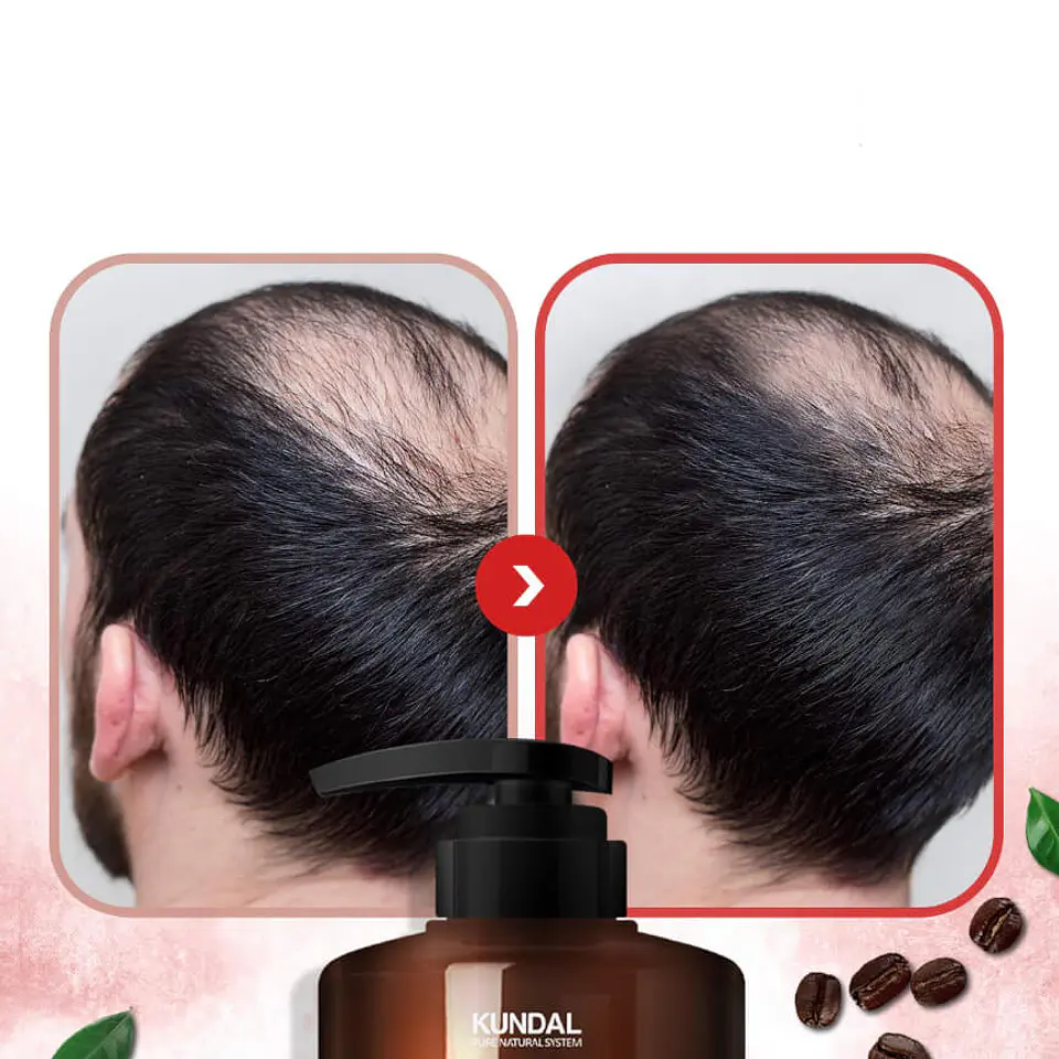 Caffeine Deep Cleansing Shampoo Anticaída de cabello con cafeína (Kundal) - 500ml 4