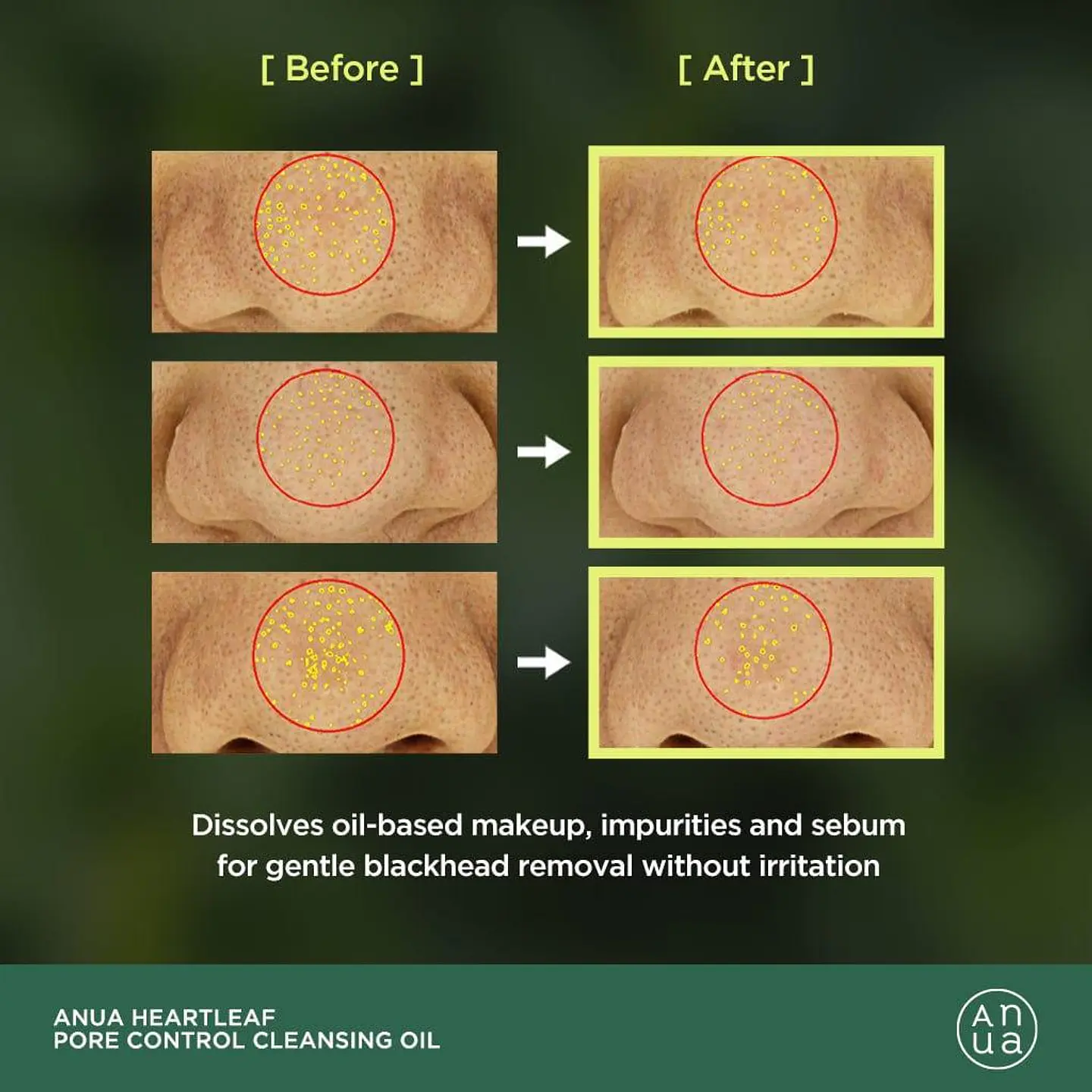  Heartleaf Pore Control Cleansing Oil - 200ml (Anua) -Limpiador oleoso desmaquillante  10