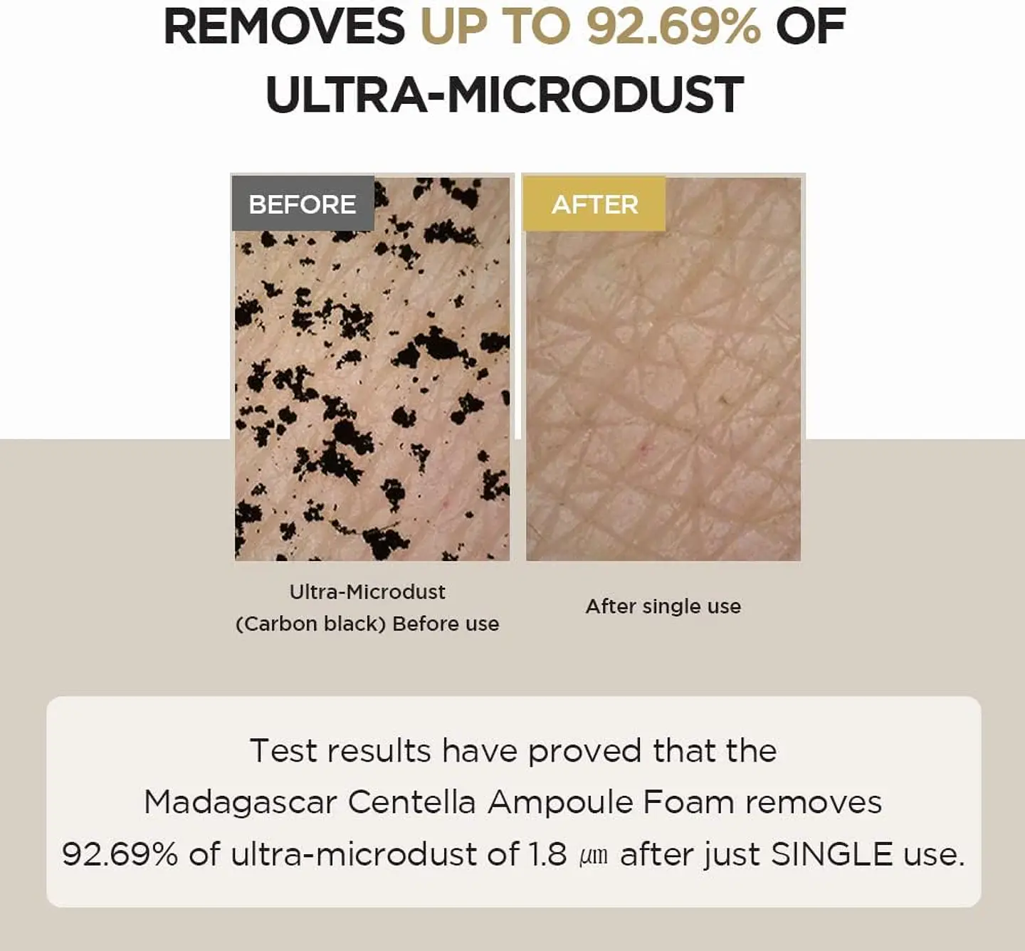 Madagascar Centella Ampoule Foam (SKIN1004) - 125ml Limpiador en espuma calmante pieles sensibles 7