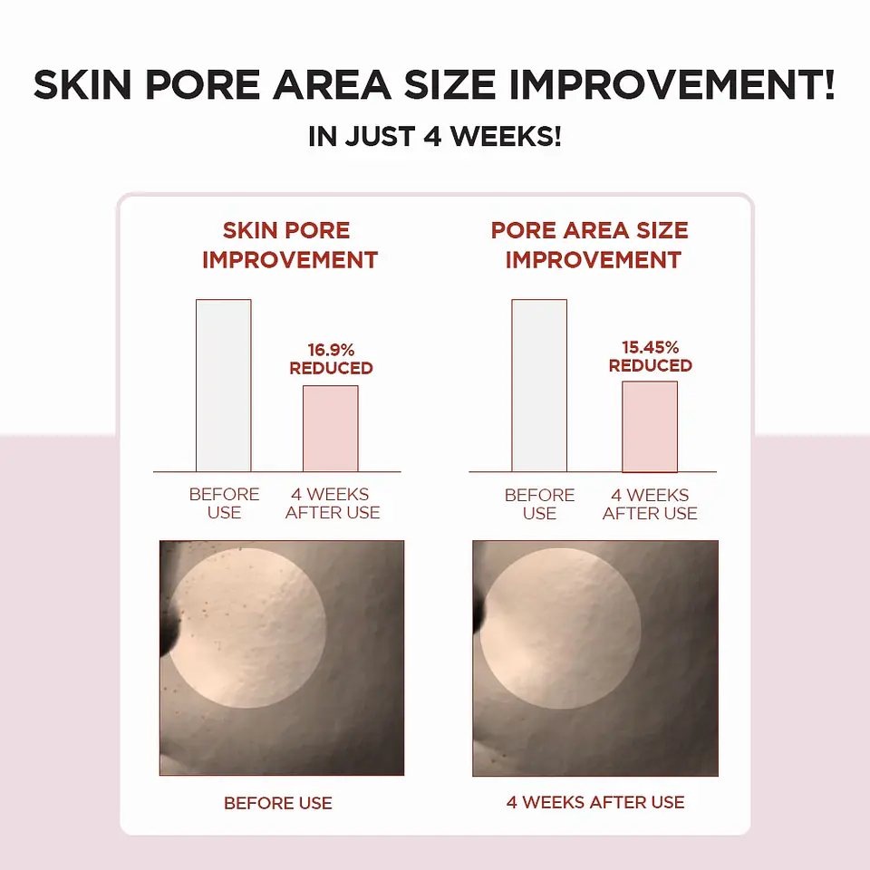 Madagascar Centella Poremizing Fresh Ampoule (SKIN1004) - 30ml Serum poros dilatados 10