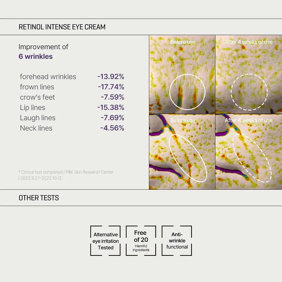 Retinol Intense Trial Kit (Some By Mi) - Set de Serum 10ml + Contorno de ojos antiedad 10ml con retinol 4