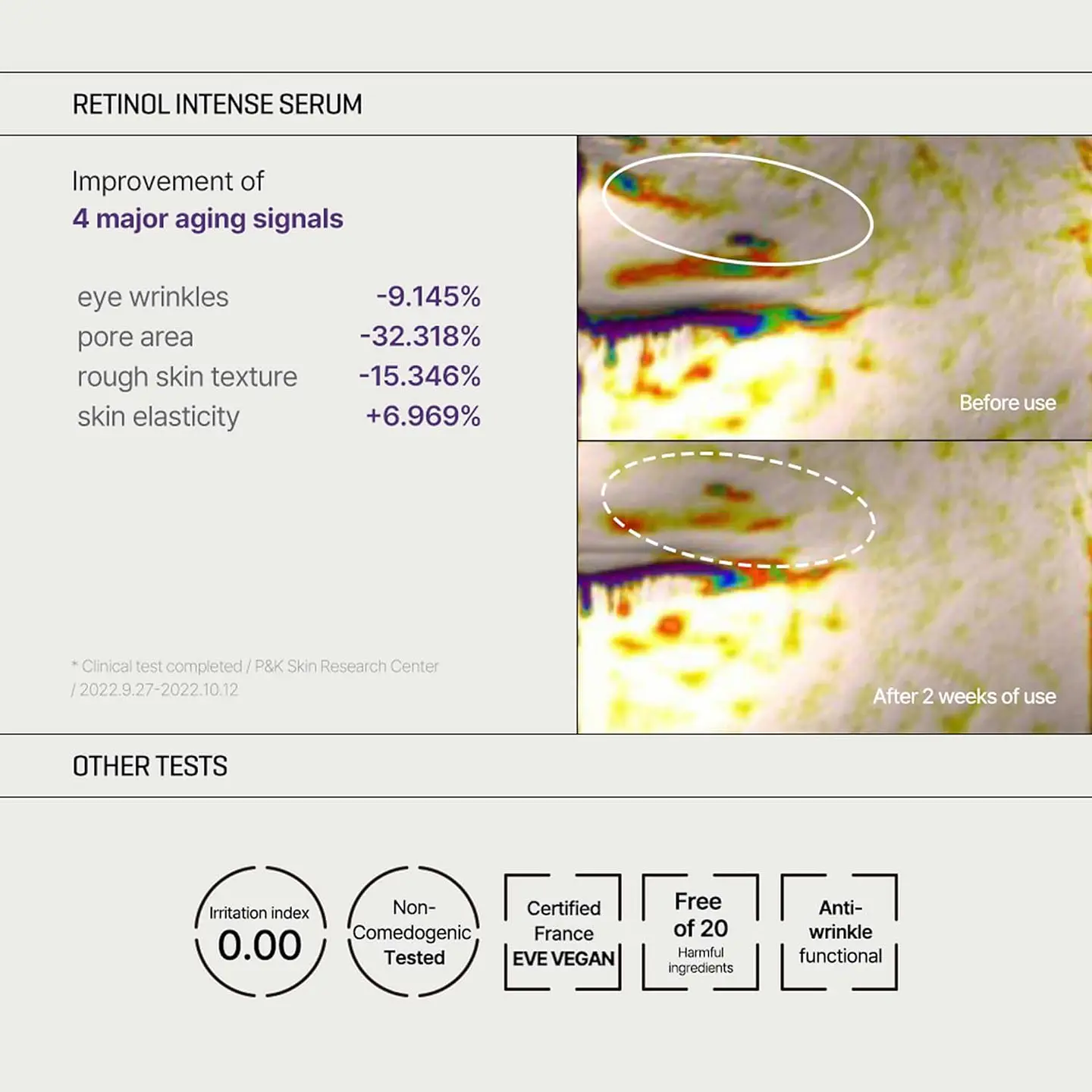 Retinol Intense Trial Kit (Some By Mi) - Set de Serum 10ml + Contorno de ojos antiedad 10ml con retinol 5