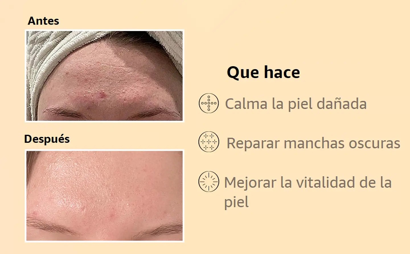 Advanced Snail 96 Mucin Power Essence (COSRX) - 100ml Esencia 96% baba de caracol 2