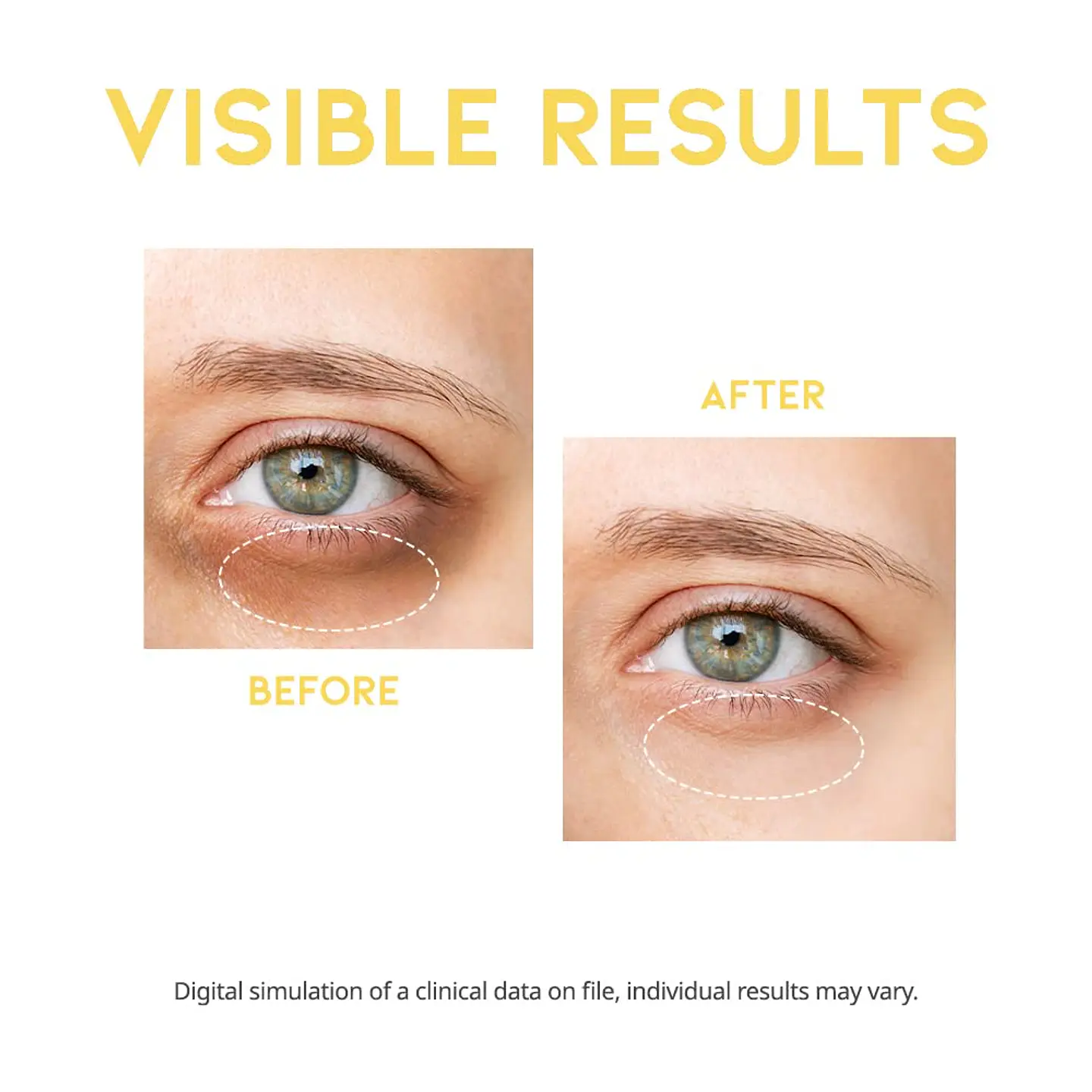 Dark Circle Eye Serum (OOTD) - 30ml Serum aclarante ojeras oscuras 9