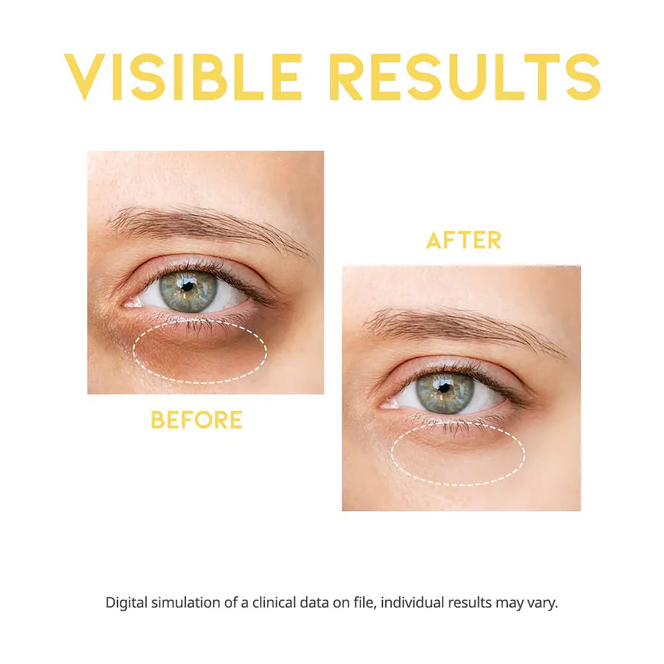 Dark Circle Eye Serum (OOTD) - 30ml Serum aclarante ojeras oscuras 9
