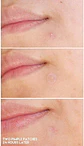 Acne Pimple Master Patch (COSRX) - Sobres con 24 parches hidrocoloides para espinillas - Miniatura 17