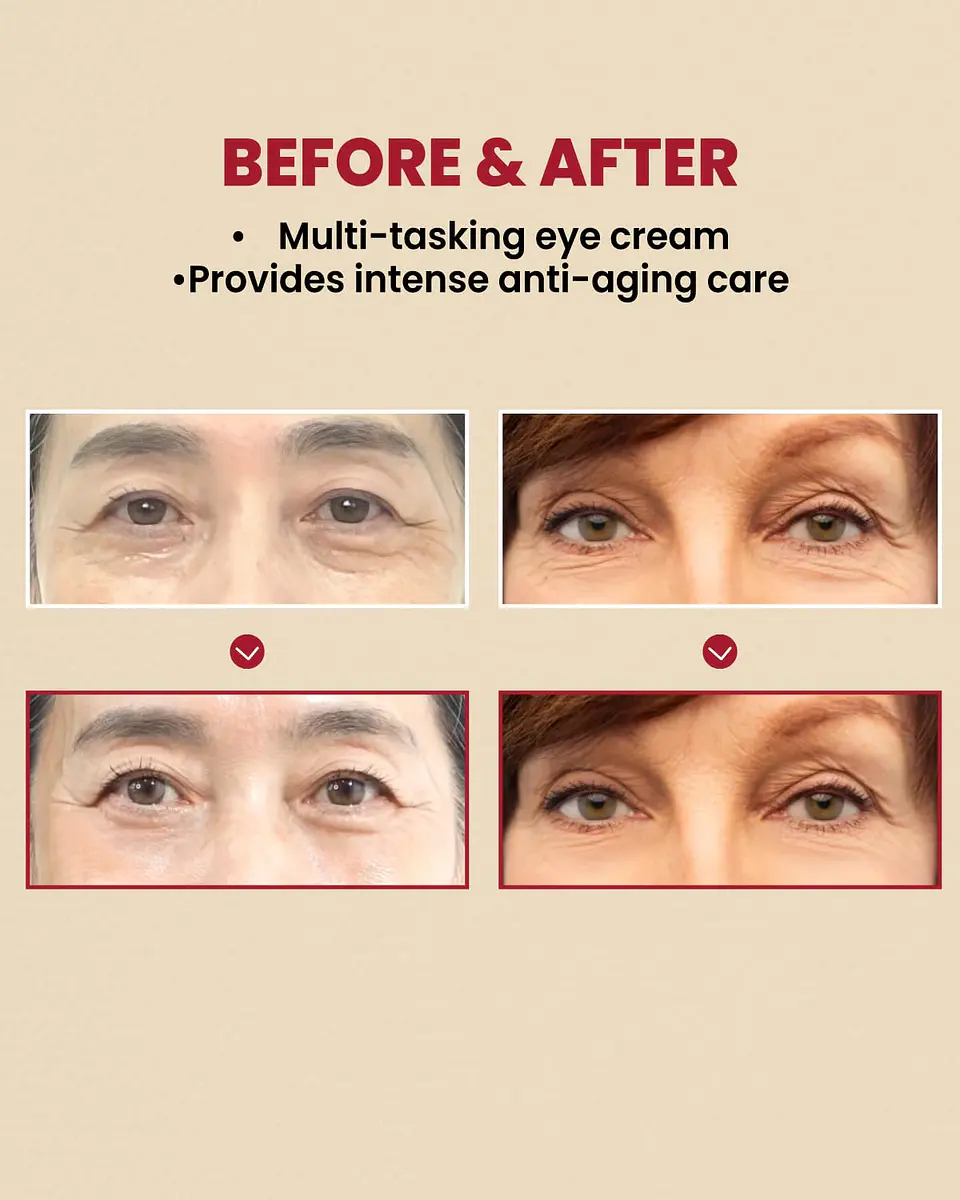 Seoul 1988 Eye Cream: Retinal Liposome 4% + Fermented Bean (K-Secret) -30ml Crema contorno de ojos antiedad con retinal, bakuchiol y péptidos 4