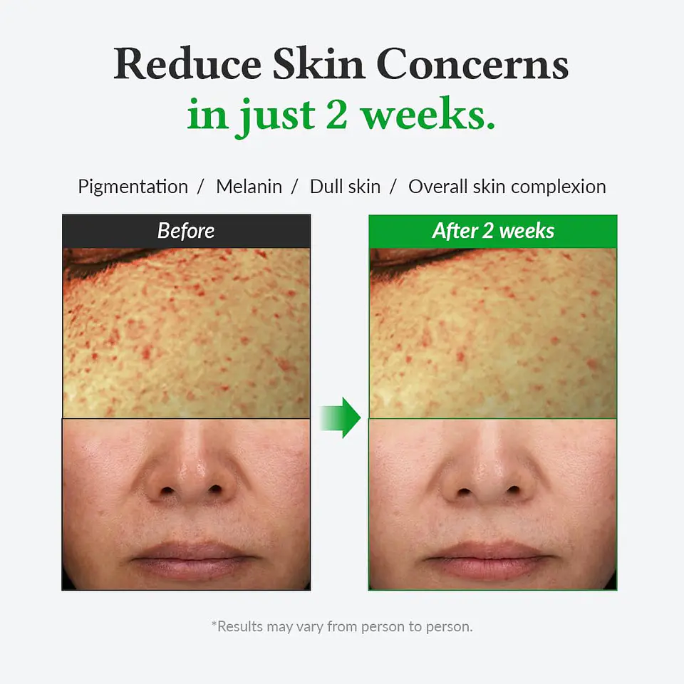 Gentle Vitamin C Serum (Dr Althea) - 30ml Serum iluminador con vitamina C pieles sensibles 5