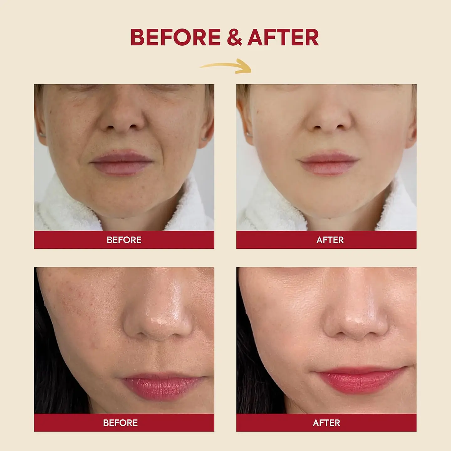 Seoul 1988 Essence: Snail Mucin 97% + Rice (K-Secret) - 100ml Concentrado regenerador e iluminador con baba de caracol y arroz 5