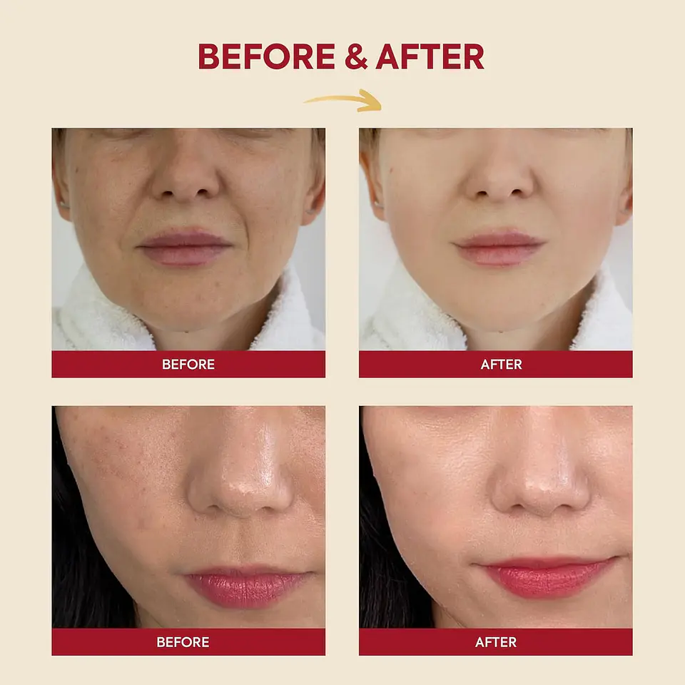 Seoul 1988 Essence: Snail Mucin 97% + Rice (K-Secret) - 100ml Concentrado regenerador e iluminador con baba de caracol y arroz 5