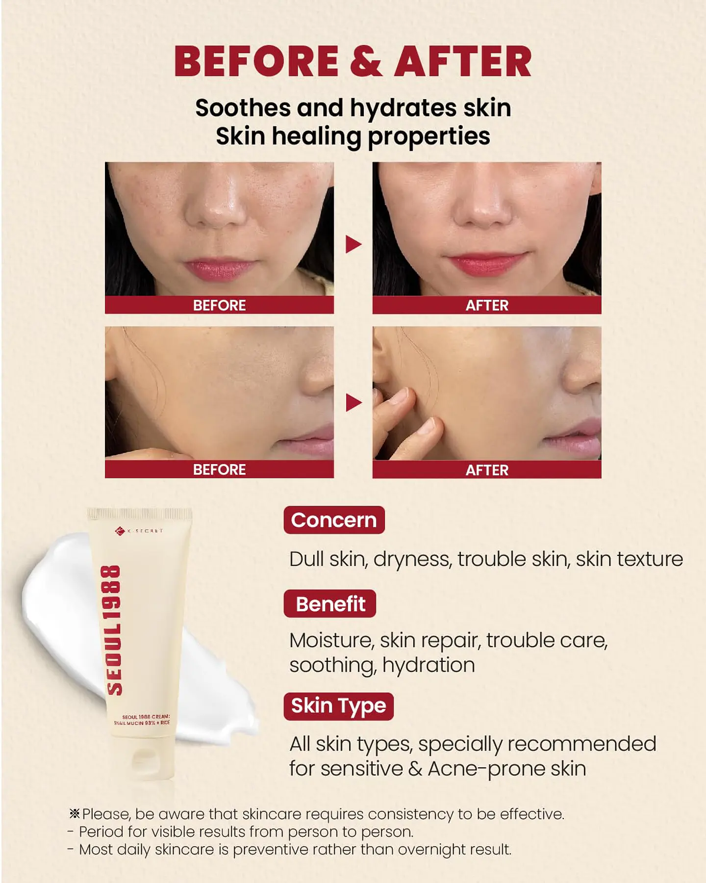Seoul 1988 Cream: Snail Mucin 93% + Rice (K-Secret) - 100ml Crema regeneradora e iluminadora con baba de caracol y arroz 5