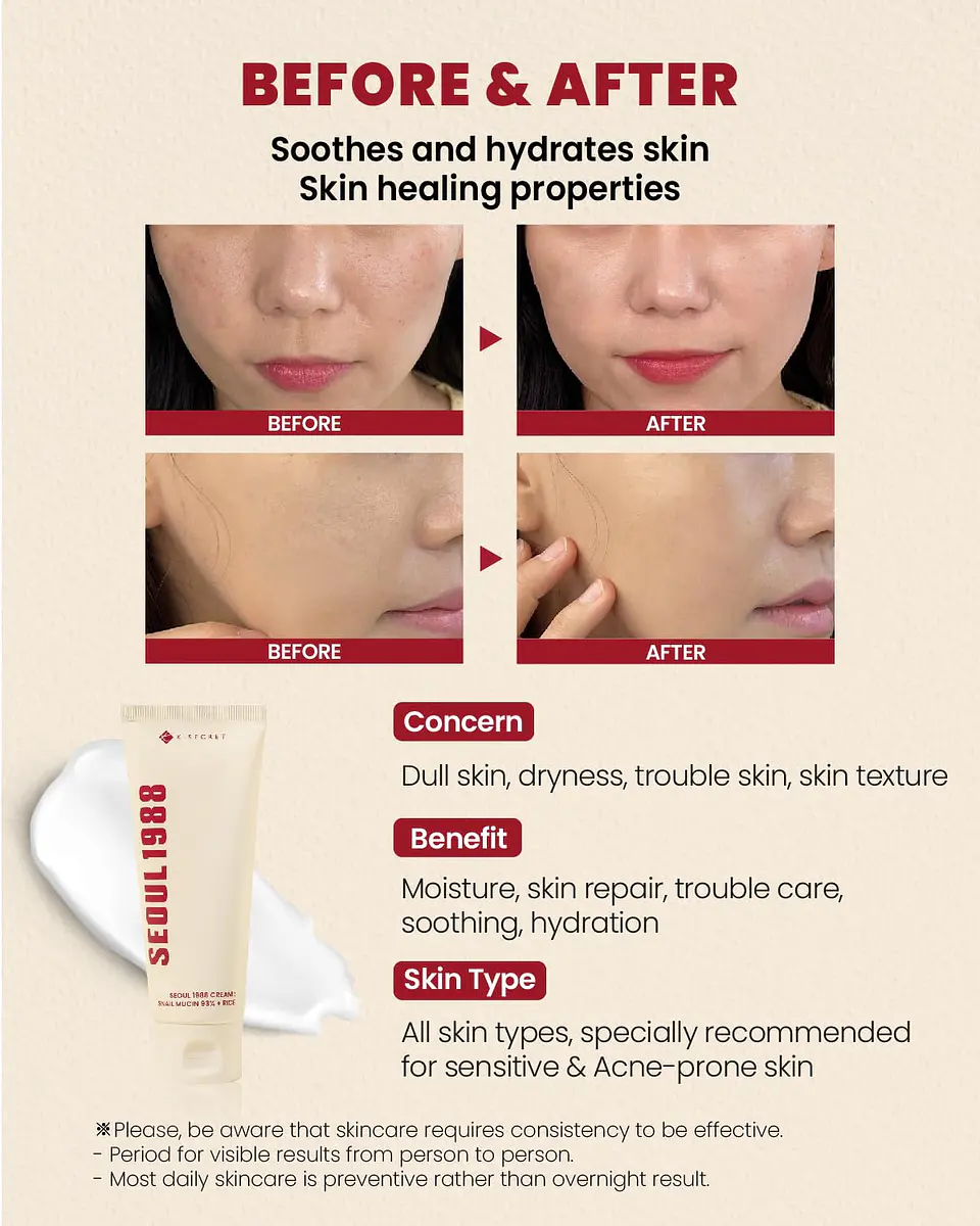 Seoul 1988 Cream: Snail Mucin 93% + Rice (K-Secret) - 100ml Crema regeneradora e iluminadora con baba de caracol y arroz 5