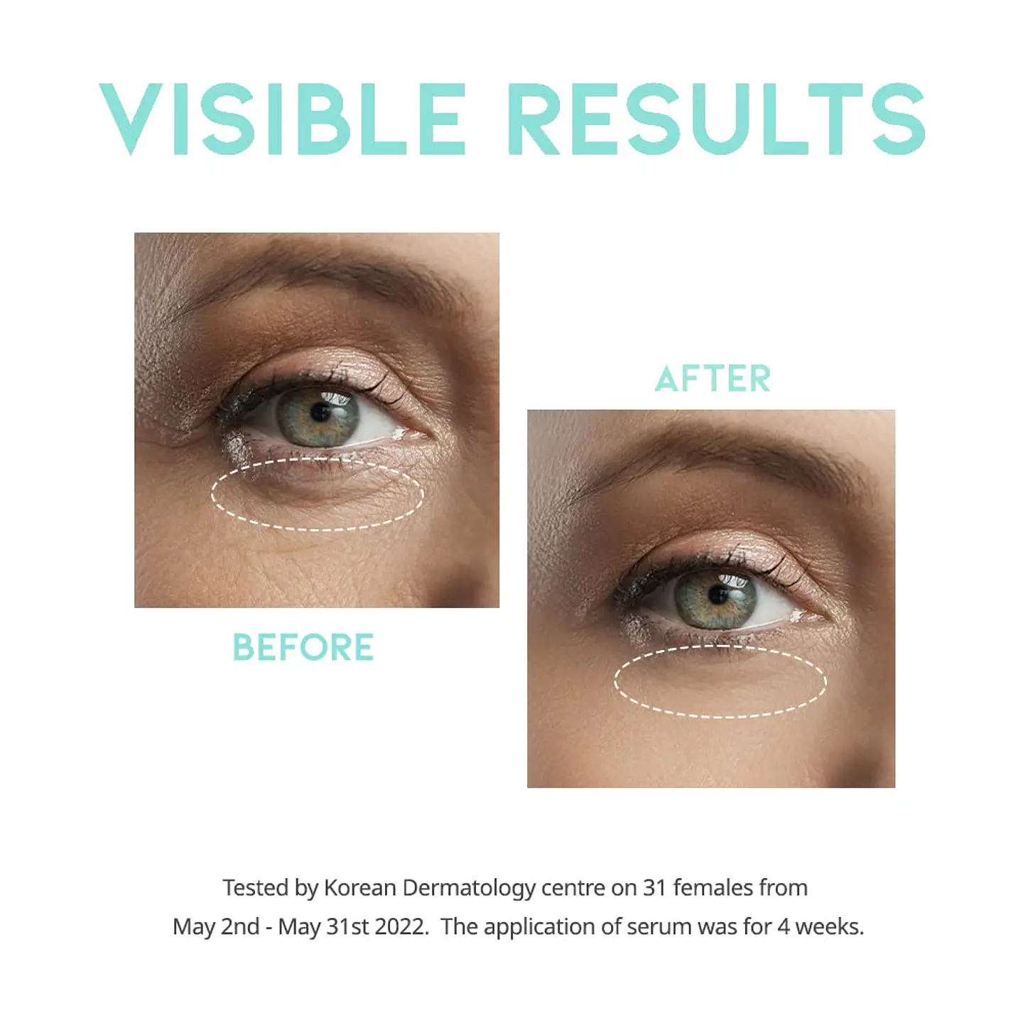 Wrinkle Lift Eye Serum (OOTD) - 30ml Serum contorno de ojos antiedad 3