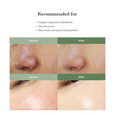 Premium Quick Step Sebum Cleanser (Dr Althea) - 100ml Limpiador focalizado anti grasitud y puntos negros