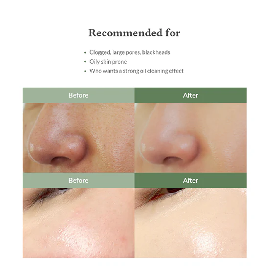 Premium Quick Step Sebum Cleanser (Dr Althea) - 100ml Limpiador focalizado anti grasitud y puntos negros 2