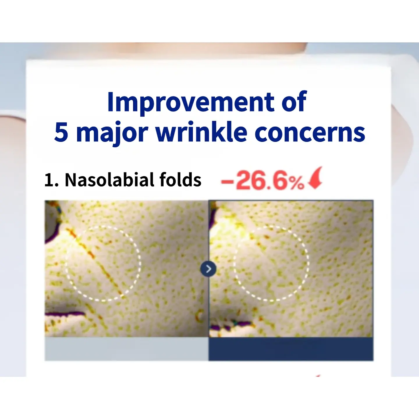 Retinol 2500 IU Wrinkle Shot Perfector (Boncept de Tonymoly) - Tratamiento antiedad intensivo 5