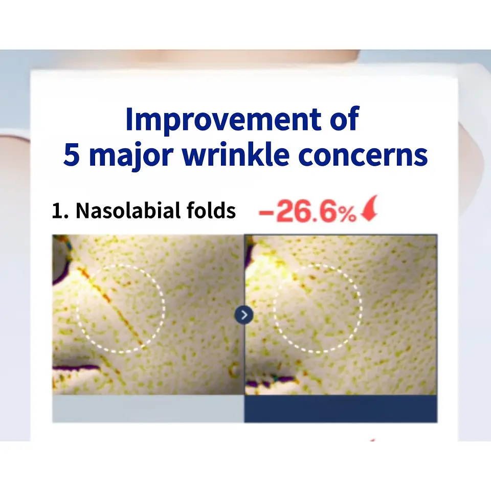 Retinol 2500 IU Wrinkle Shot Perfector (Boncept de Tonymoly) - Tratamiento antiedad intensivo 5